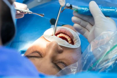 ağız ve çene cerrahisi